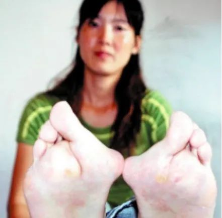 举重历史_举重历史前十_举重史上的奇迹